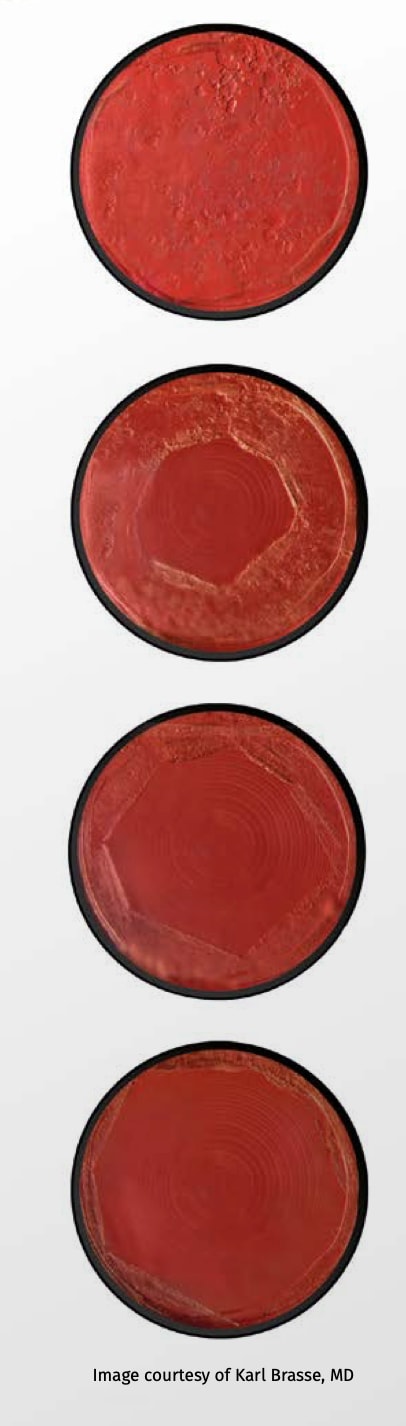 Ellex Tango Reflex Neo SLT – YAG – Vitreolysis Lazer – Ellex (3. görsel)