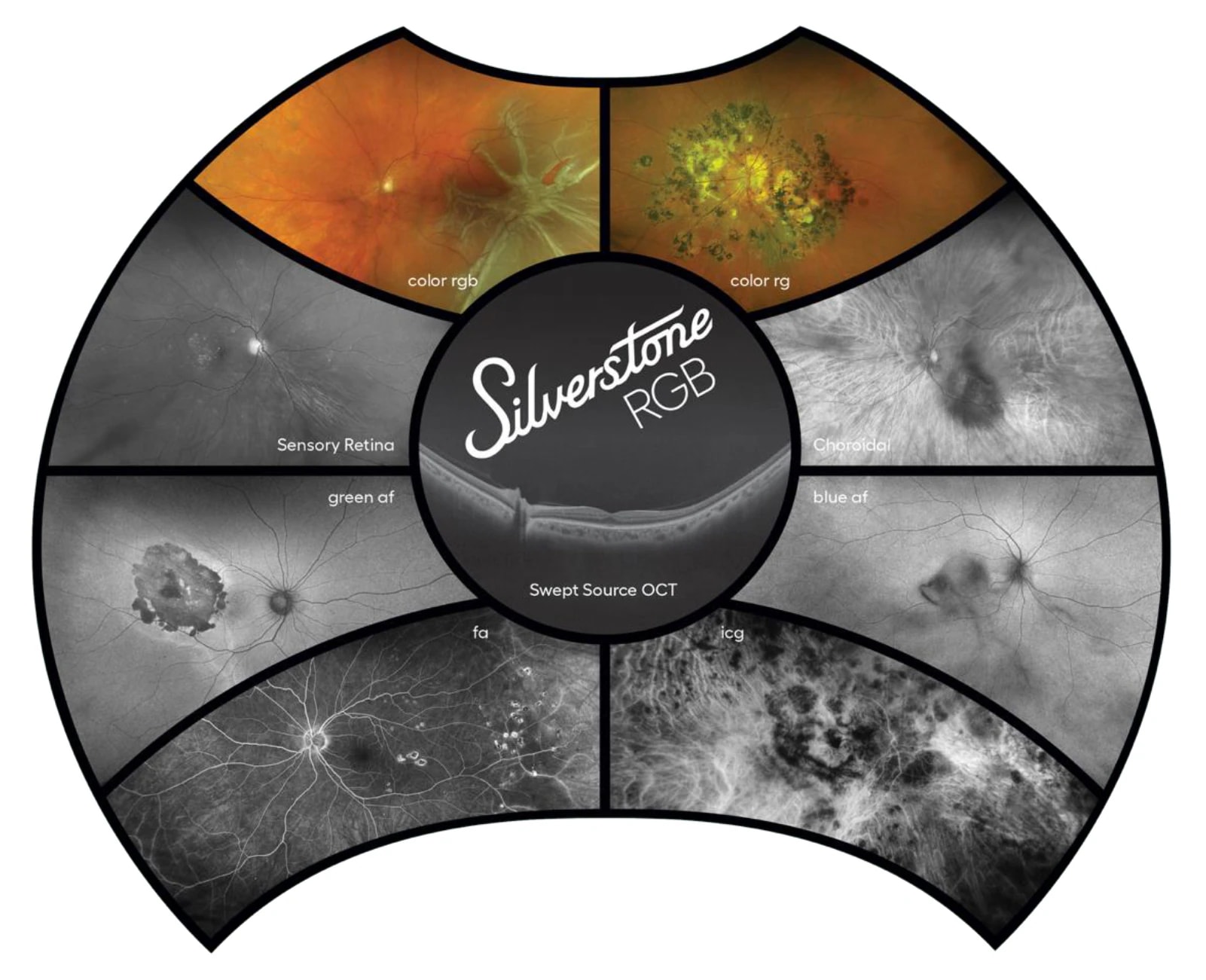 Silverstone SS OCT – Optos (2. görsel)