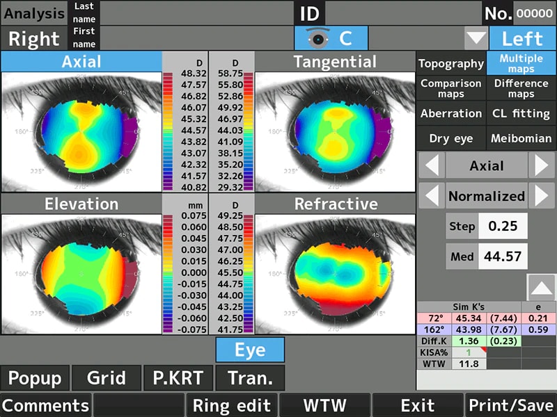RET-700 Otorefkerato-Topografi – Rexxam (2. görsel)