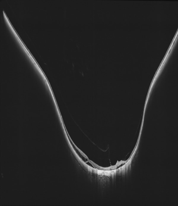 DREAM OCT VG 200D – Intalight (4. görsel)