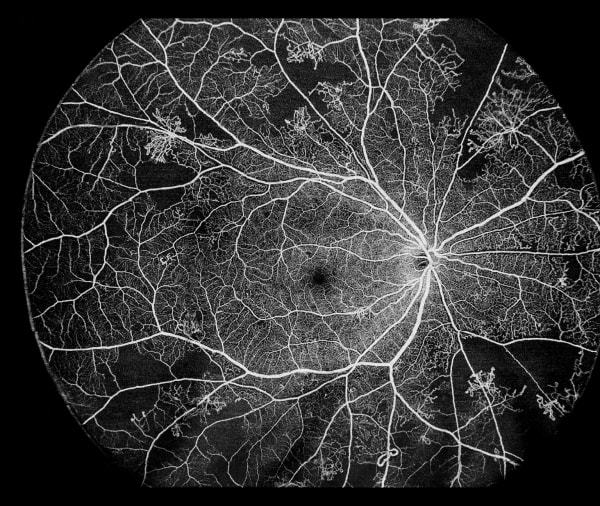 DREAM OCT VG 100D – Intalight (4. görsel)